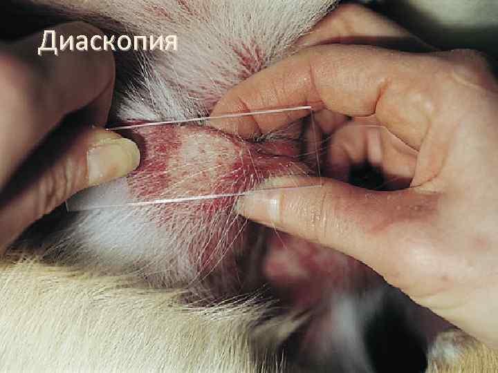 Диаскопия 