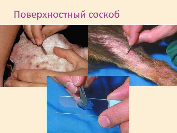 Поверхностный соскоб 