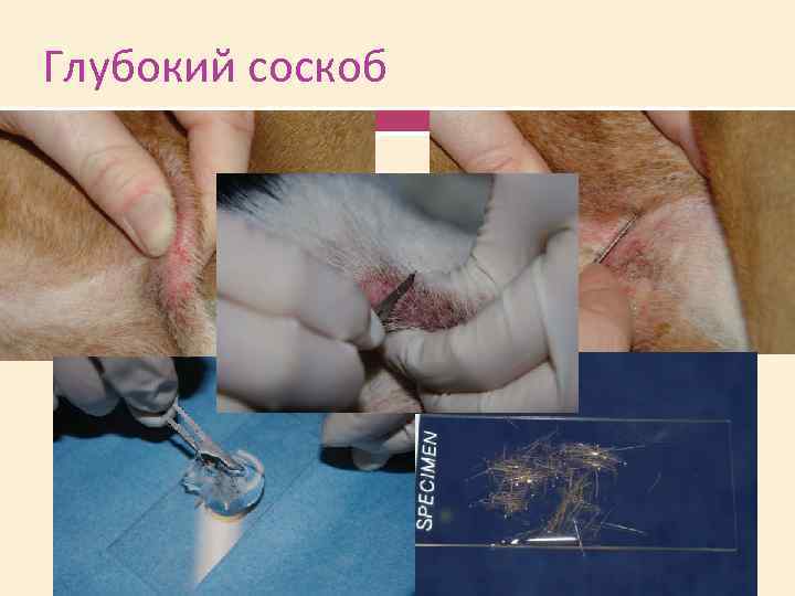 Глубокий соскоб 