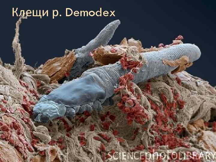 Клещи р. Demodex 
