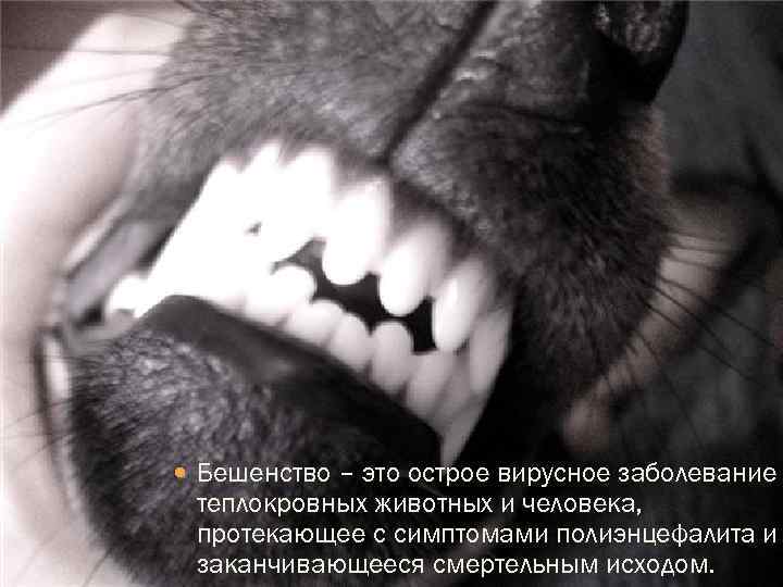  Бешенство – это острое вирусное заболевание теплокровных животных и человека, протекающее с симптомами