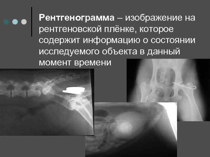 Рентгенограмма – изображение на рентгеновской плёнке, которое содержит информацию о состоянии исследуемого объекта в