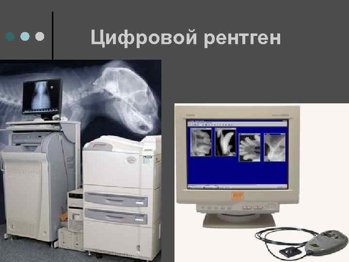 Цифровой рентген 