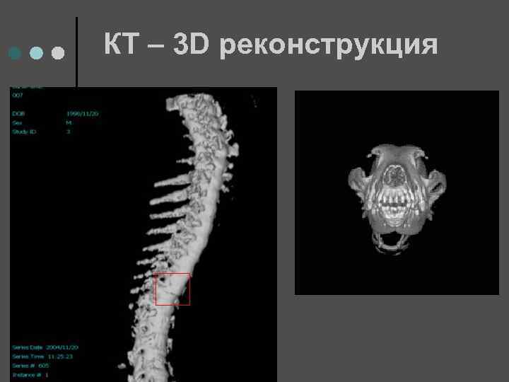 КТ – 3 D реконструкция 