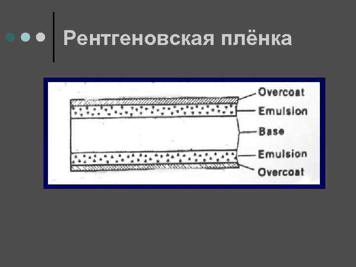 Рентгеновская плёнка 