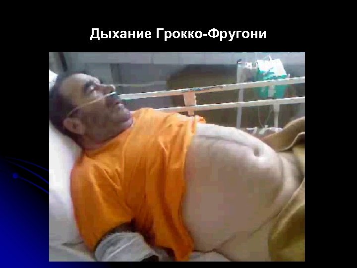 Дыхание Грокко-Фругони 