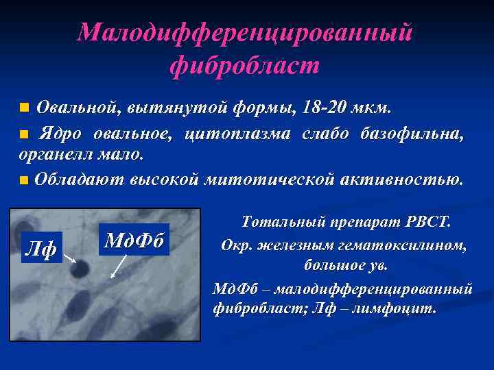 Малодифференцированный фибробласт n Овальной, вытянутой формы, 18 -20 мкм. n Ядро овальное, цитоплазма слабо