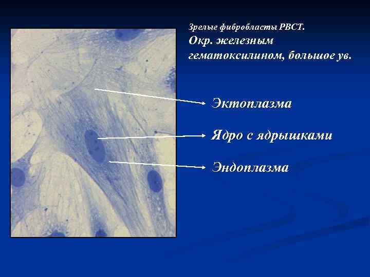 Зрелые фибробласты РВСТ. Окр. железным гематоксилином, большое ув. Эктоплазма Ядро с ядрышками Эндоплазма 