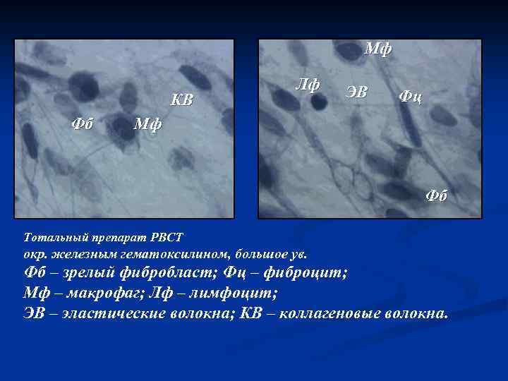 Мф КВ Фб Лф ЭВ Фц Мф Фб Тотальный препарат РВСТ окр. железным гематоксилином,