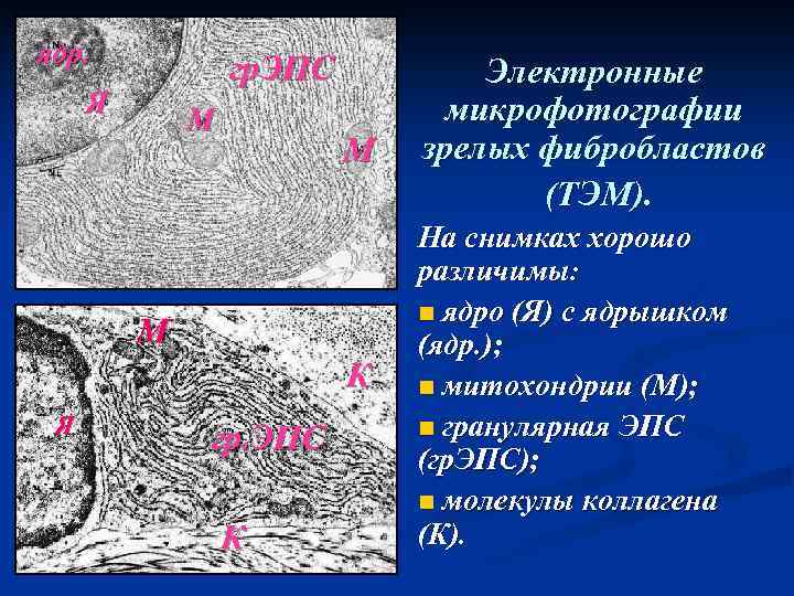 ядр. гр. ЭПС Я М М М К Я гр. ЭПС К Электронные микрофотографии