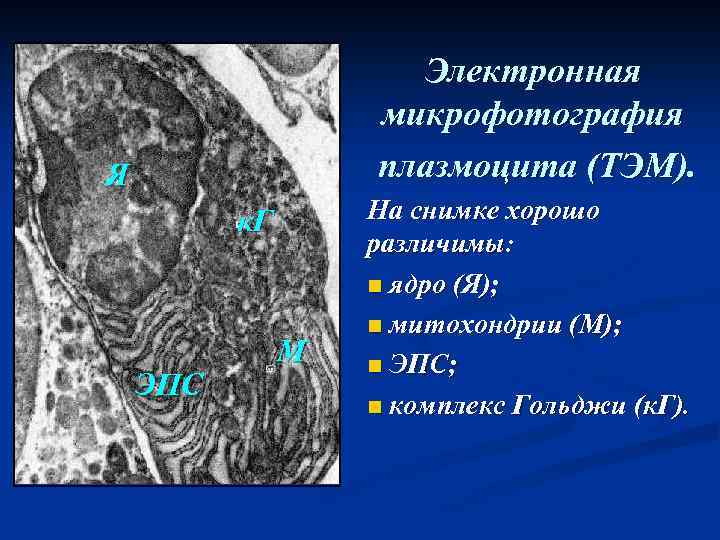 Электронная микрофотография плазмоцита (ТЭМ). Я к. Г ЭПС М На снимке хорошо различимы: n