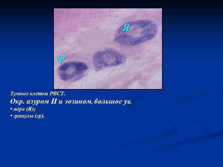 Я гр Тучные клетки РВСТ. Окр. азуром II и эозином, большое ув. • ядро