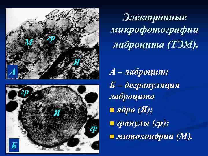 М Электронные микрофотографии лаброцита (ТЭМ). гр Я А гр Я гр Б А –