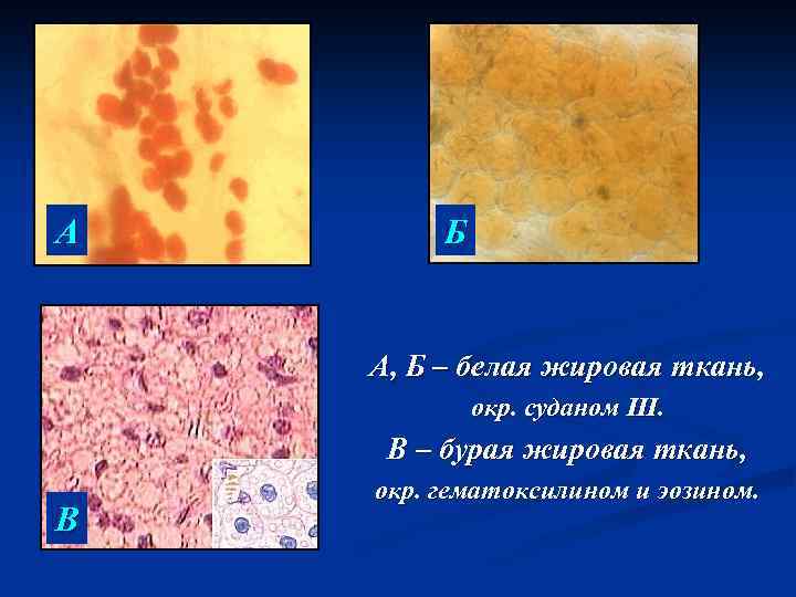 А Б А, Б – белая жировая ткань, окр. суданом III. В – бурая