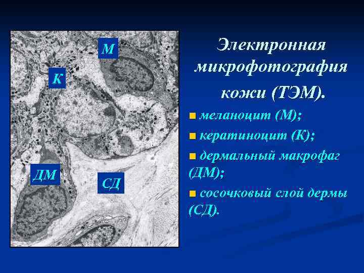 М К Электронная микрофотография кожи (ТЭМ). n меланоцит (М); n кератиноцит (К); n дермальный