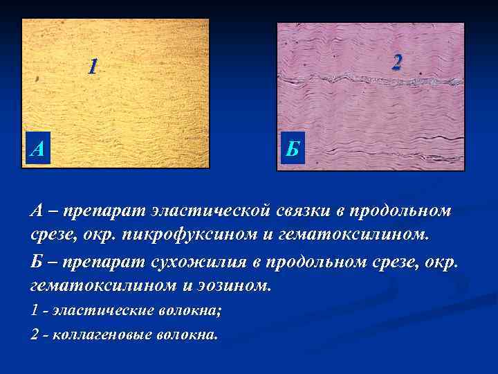 2 1 А Б А – препарат эластической связки в продольном срезе, окр. пикрофуксином