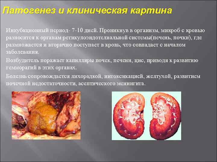 Патогенез и клиническая картина Инкубационный период 7 10 дней. Проникнув в организм, микроб с