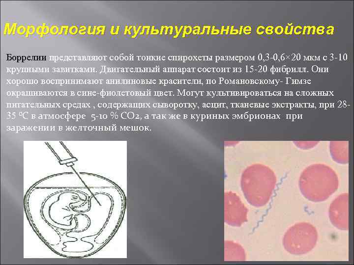 Морфология и культуральные свойства Боррелии представляют собой тонкие спирохеты размером 0, 3 0, 6×