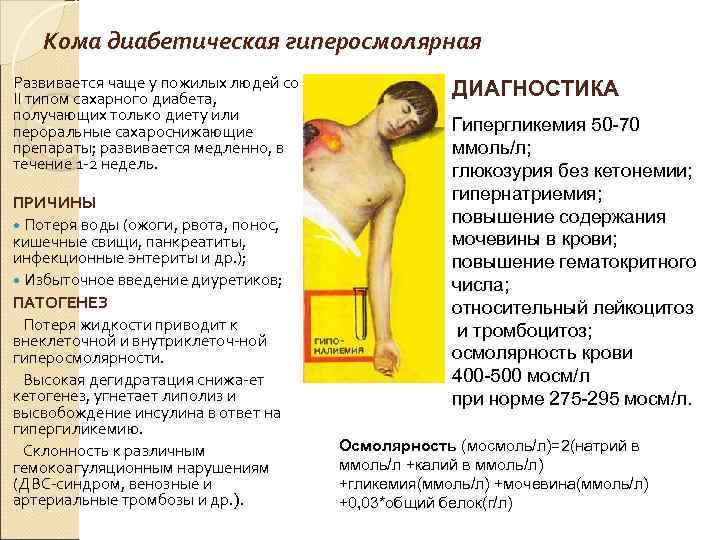 Кома диабетическая гиперосмолярная Развивается чаще у пожилых людей со ІІ типом сахарного диабета, получающих
