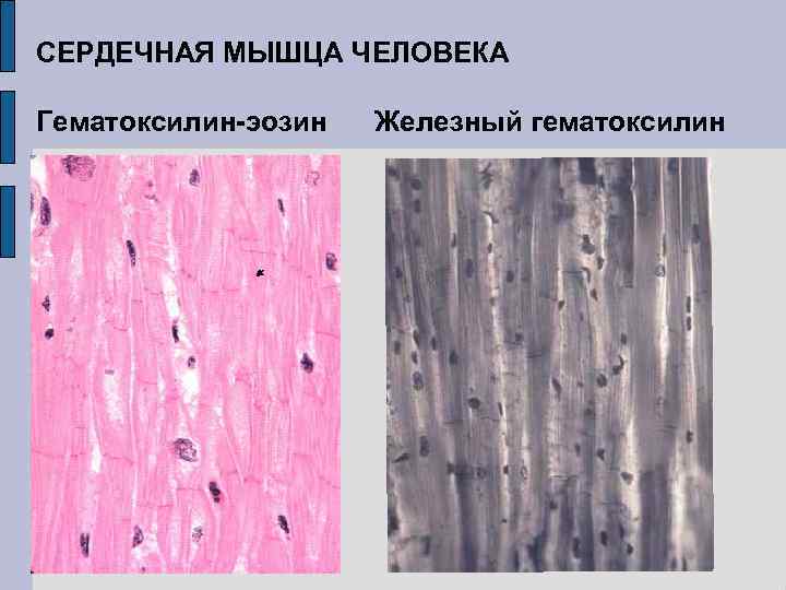 СЕРДЕЧНАЯ МЫШЦА ЧЕЛОВЕКА Гематоксилин-эозин Железный гематоксилин 