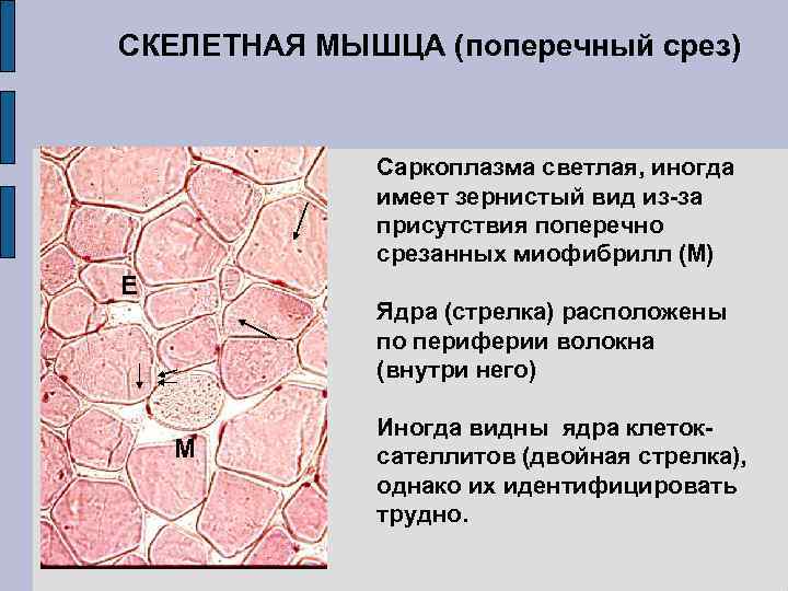 СКЕЛЕТНАЯ МЫШЦА (поперечный срез) Саркоплазма светлая, иногда имеет зернистый вид из-за присутствия поперечно срезанных