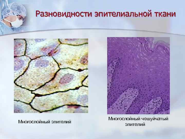 Разновидности эпителиальной ткани Многослойный эпителий Многослойный чешуйчатый эпителий 