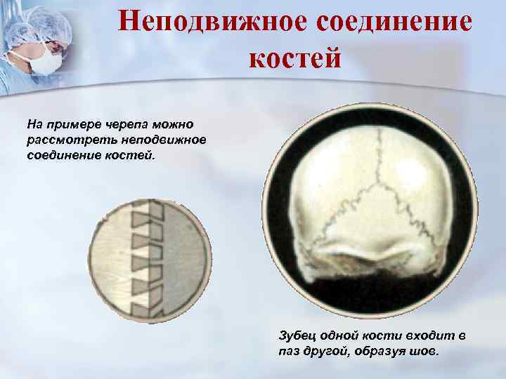 Неподвижное соединение костей На примере черепа можно рассмотреть неподвижное соединение костей. Зубец одной кости