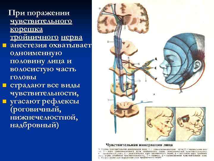 При поражении чувствительного корешка тройничного нерва n анестезия охватывает одноименную половину лица и волосистую