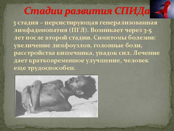 Стадии развития СПИДа 3 стадия – персистирующая генерализованная лимфаденопатия (ПГЛ). Возникает через 3 -5