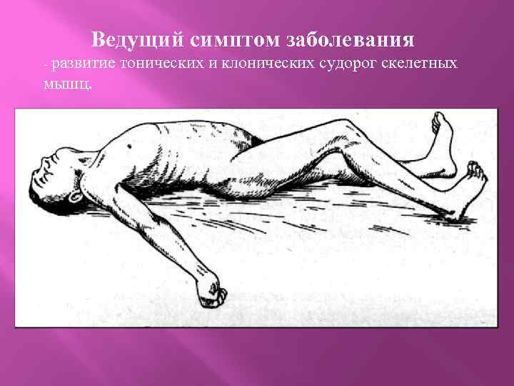 Ведущий симптом. Энцефалитический столбняк. Презентация на тему столбняк.