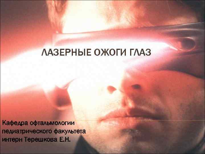 ЛАЗЕРНЫЕ ОЖОГИ ГЛАЗ Кафедра офтальмологии педиатрического факультета интерн Терешкова Е. Н. 