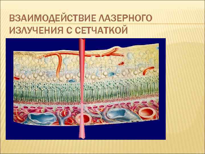 ВЗАИМОДЕЙСТВИЕ ЛАЗЕРНОГО ИЗЛУЧЕНИЯ С СЕТЧАТКОЙ 
