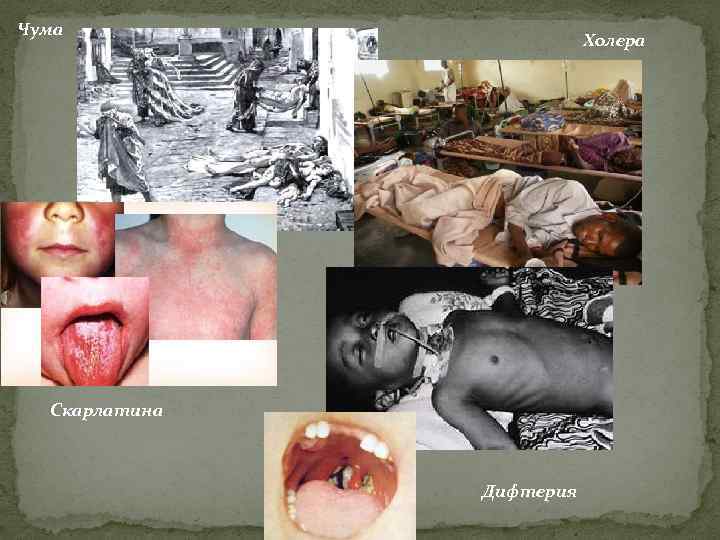 Чума Холера Скарлатина Дифтерия 