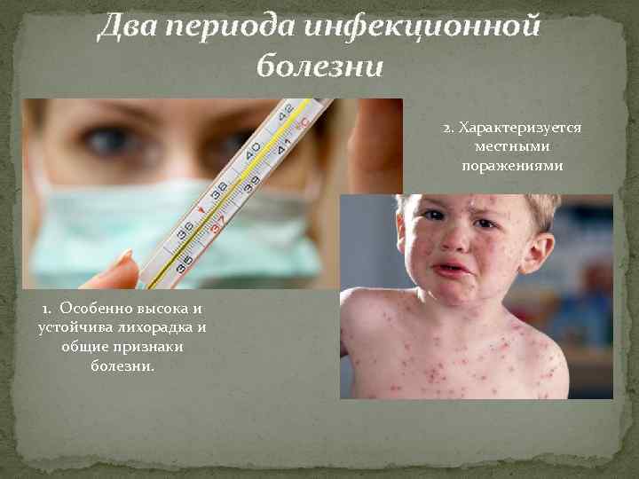 Два периода инфекционной болезни 2. Характеризуется местными поражениями 1. Особенно высока и устойчива лихорадка