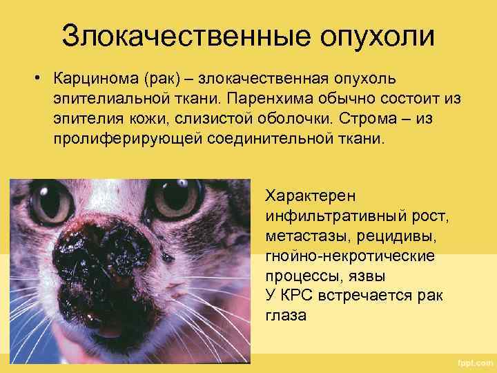 Злокачественные опухоли • Карцинома (рак) – злокачественная опухоль эпителиальной ткани. Паренхима обычно состоит из