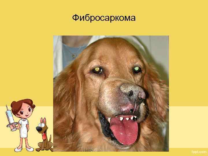 Фибросаркома 