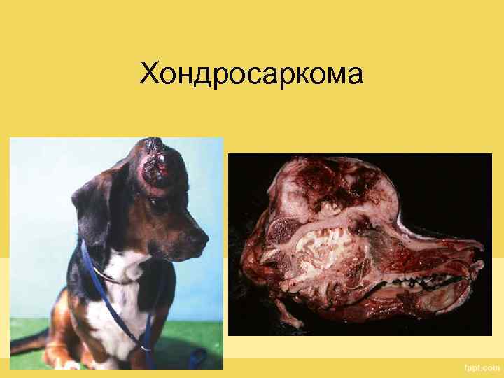 Хондросаркома 