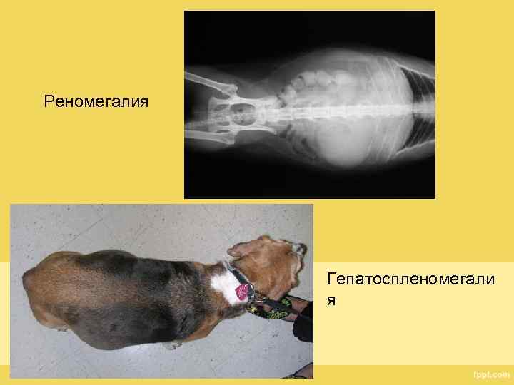 Реномегалия Гепатоспленомегали я 