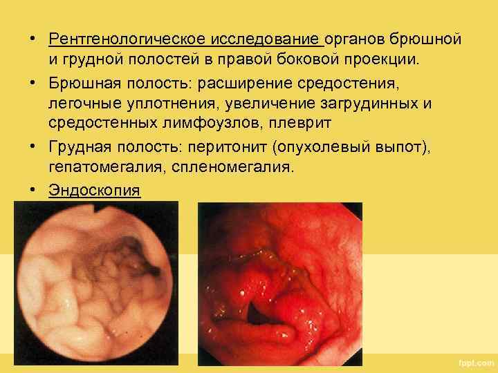  • Рентгенологическое исследование органов брюшной и грудной полостей в правой боковой проекции. •