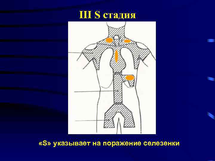 III S стадия «S» указывает на поражение селезенки 