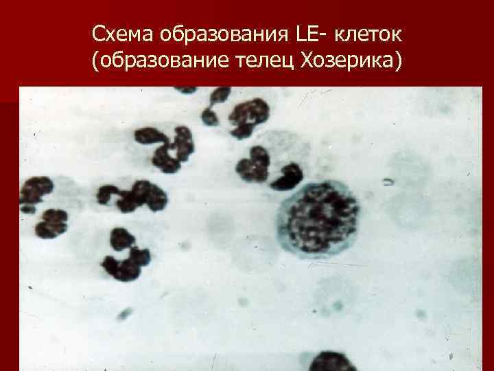 Схема образования LE клеток (образование телец Хозерика) 