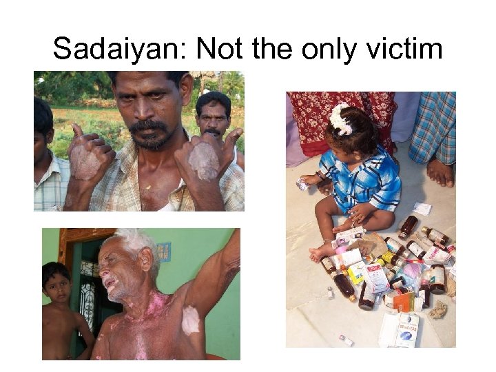 Sadaiyan: Not the only victim 