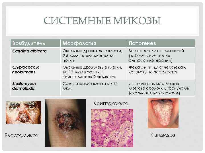 СИСТЕМНЫЕ МИКОЗЫ Возбудитель Морфология Патогенез Candida albicans Овальные дрожжевые клетки, 2 -6 мкм, псевдомицелий,