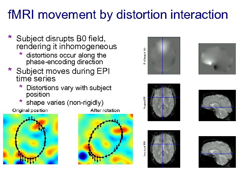 f. MRI movement by distortion interaction * Subject disrupts B 0 field, rendering it
