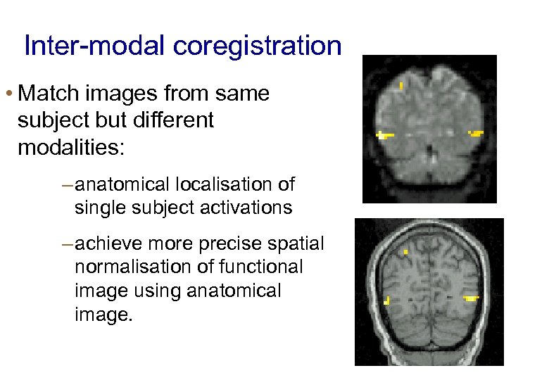 Inter-modal coregistration • Match images from same subject but different modalities: – anatomical localisation
