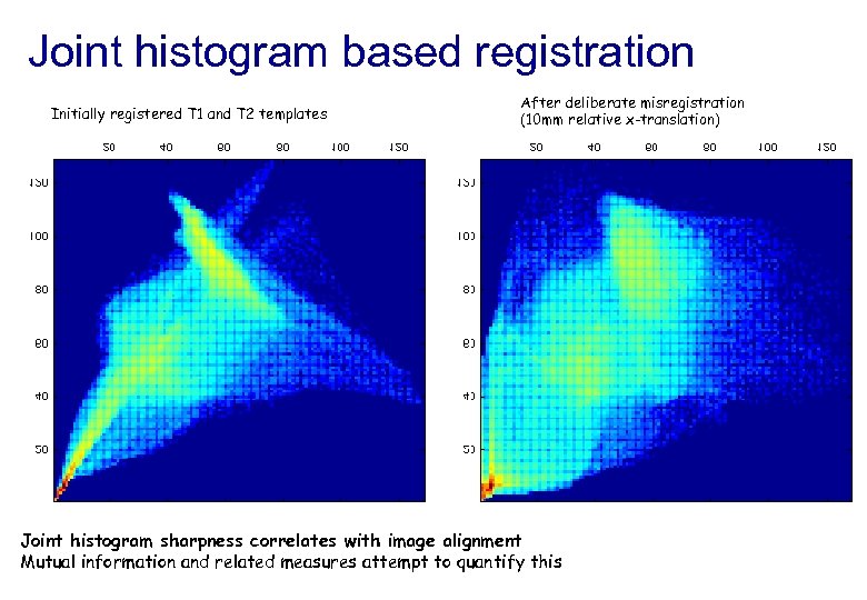 Joint histogram based registration Initially registered T 1 and T 2 templates After deliberate