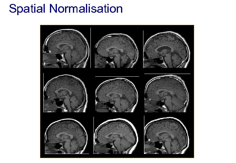Spatial Normalisation 