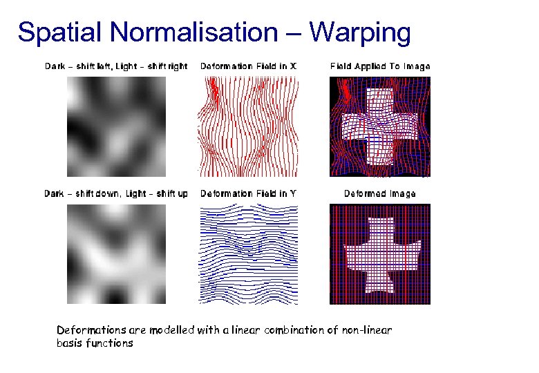Spatial Normalisation – Warping Deformations are modelled with a linear combination of non-linear basis