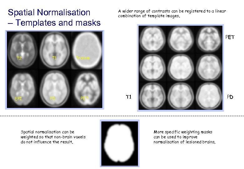 Spatial Normalisation – Templates and masks A wider range of contrasts can be registered