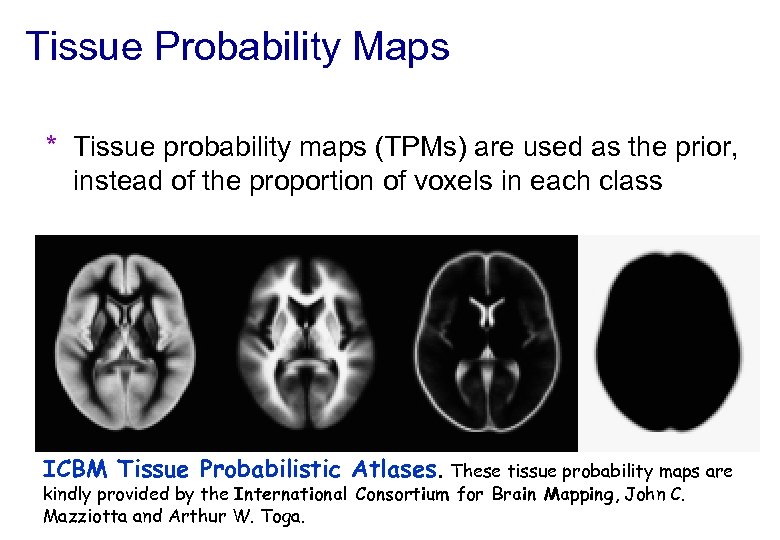 Tissue Probability Maps * Tissue probability maps (TPMs) are used as the prior, instead